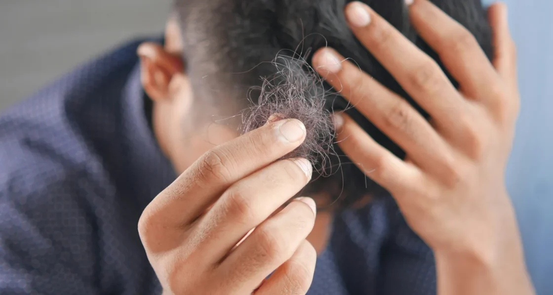 Does Creatine Cause Hair Loss? The Truth Explained